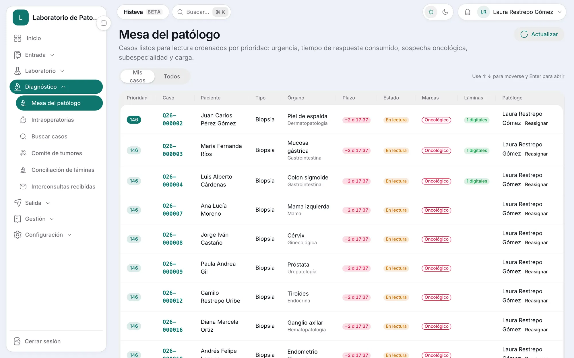 Mesa del patólogo en Histeva con casos ordenados por prioridad, plazo, órgano y subespecialidad